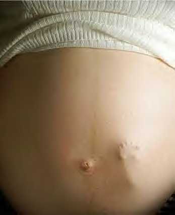 http://i732.photobucket.com/albums/ww321/moremsmani/pregnant_belly.jpg